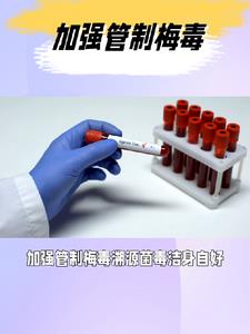 什么加强管理